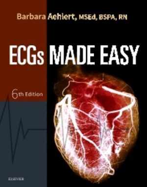 ECGs Made Easy 6th Edition Aehlert TEST BANK