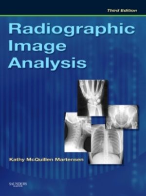 Radiographic Image Analysis 3rd Edition Martensen TEST BANK