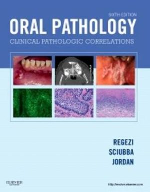 Oral Pathology Clinical Pathologic Correlations 6th Edition Regezi TEST BANK