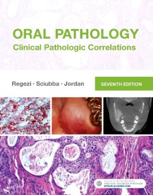 Oral Pathology 7th Edition Regezi TEST BANK
